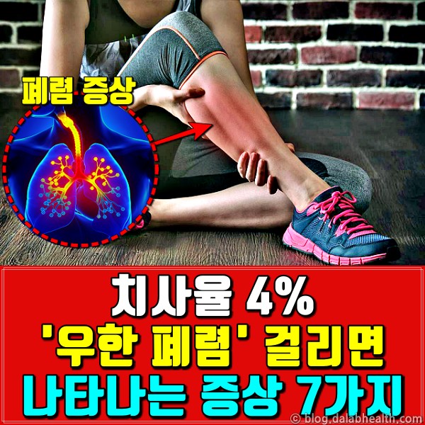 코로나 증상,우한 폐렴 증상,건강