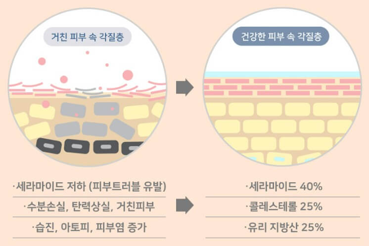 피부 장벽 보수 효과가 있는 성분 