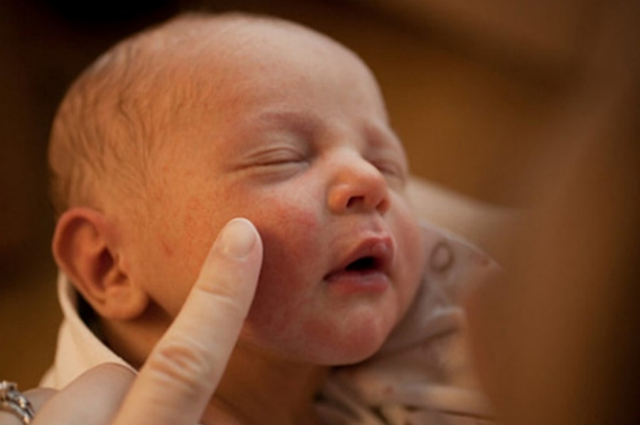 신생아의 얼굴에 붉게 나타난 태열을 엄마가 손가락으로 만지는 것을 찍은 사진