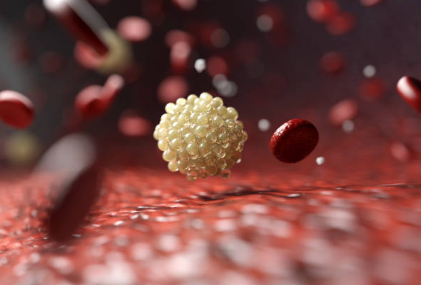 중성지방의 원리