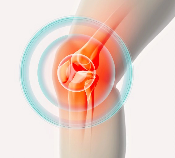 무릎 관절염 증상 치료법 및 무릎 관절염에 좋은 운동 추천