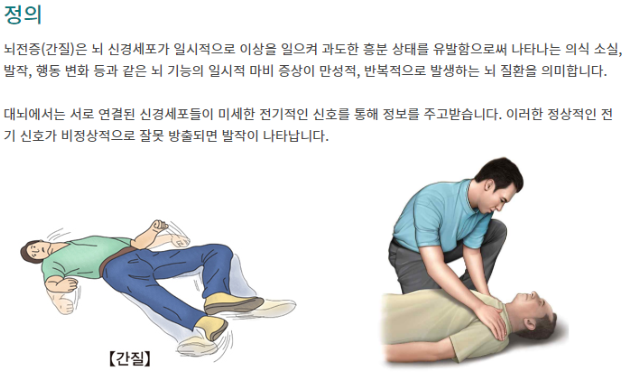 뇌전증(간질)