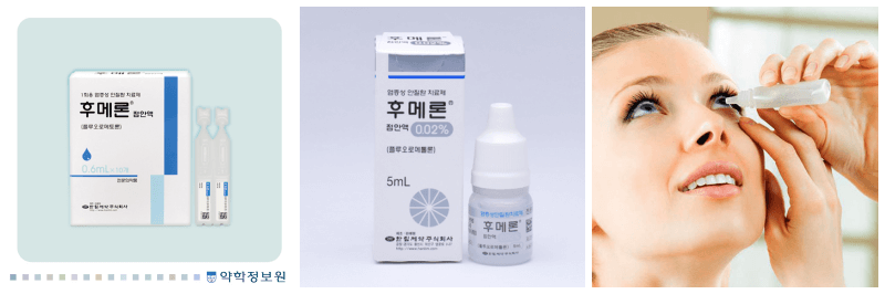 후메론점안액, 안약 넣는 사진