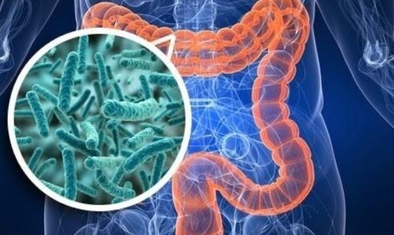 50대 장 건강 개선법과 식단, 유산균보다 더 중요한 건?