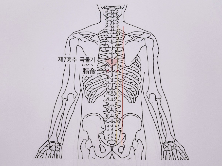 격추혈