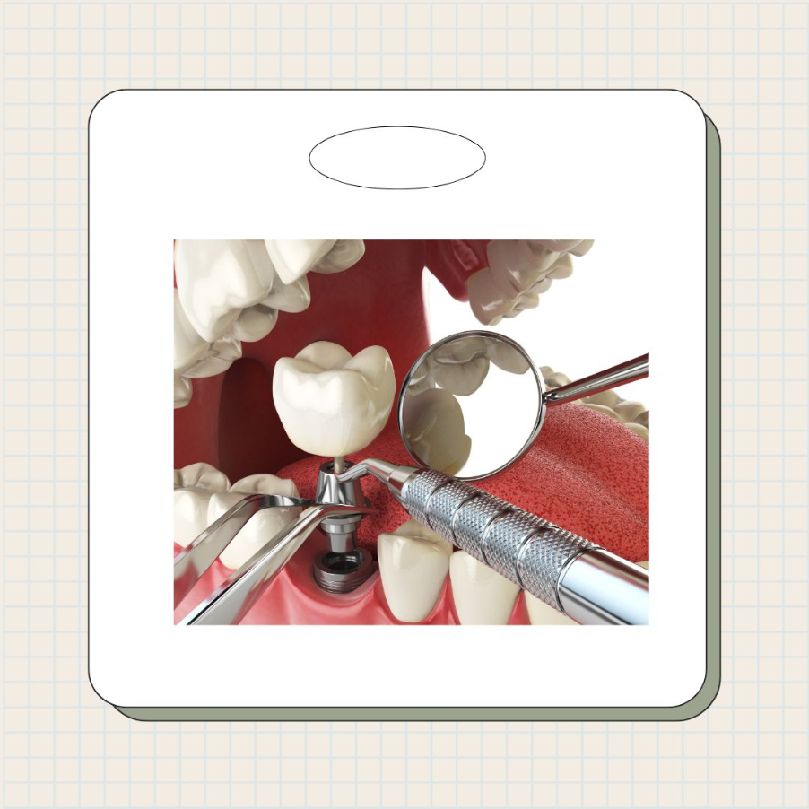 기초수급자 임플란트 추가지원금 받는 방법