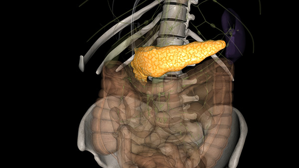 췌장암 초기증상