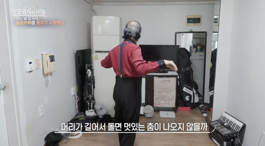 원형탈모이미지