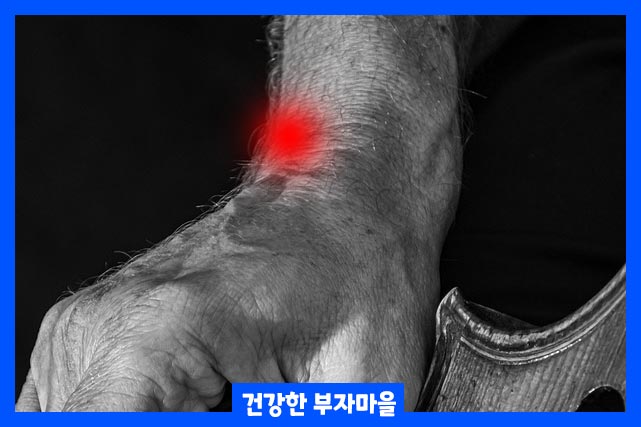 염증을 줄이기 위해 손목에 얼음 찜질하기