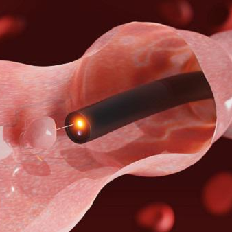 대장내시경이미지