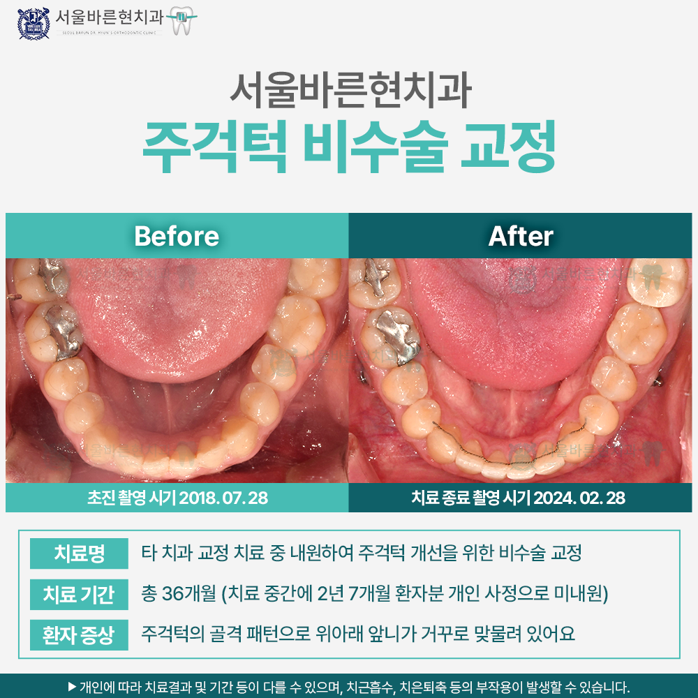 해운대교정치과