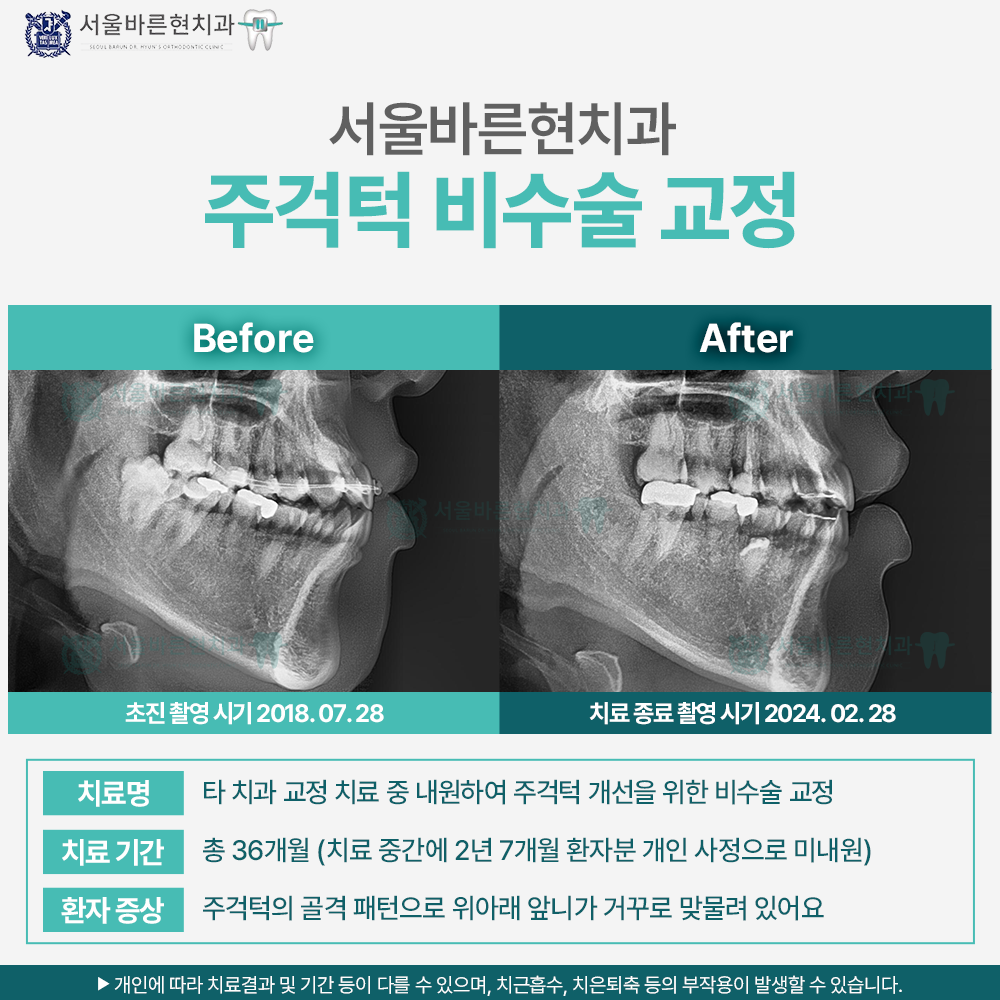 해운대교정치과