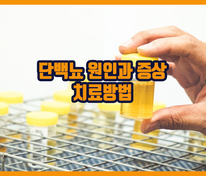 단백뇨 원인과 증상 치료방법 소개