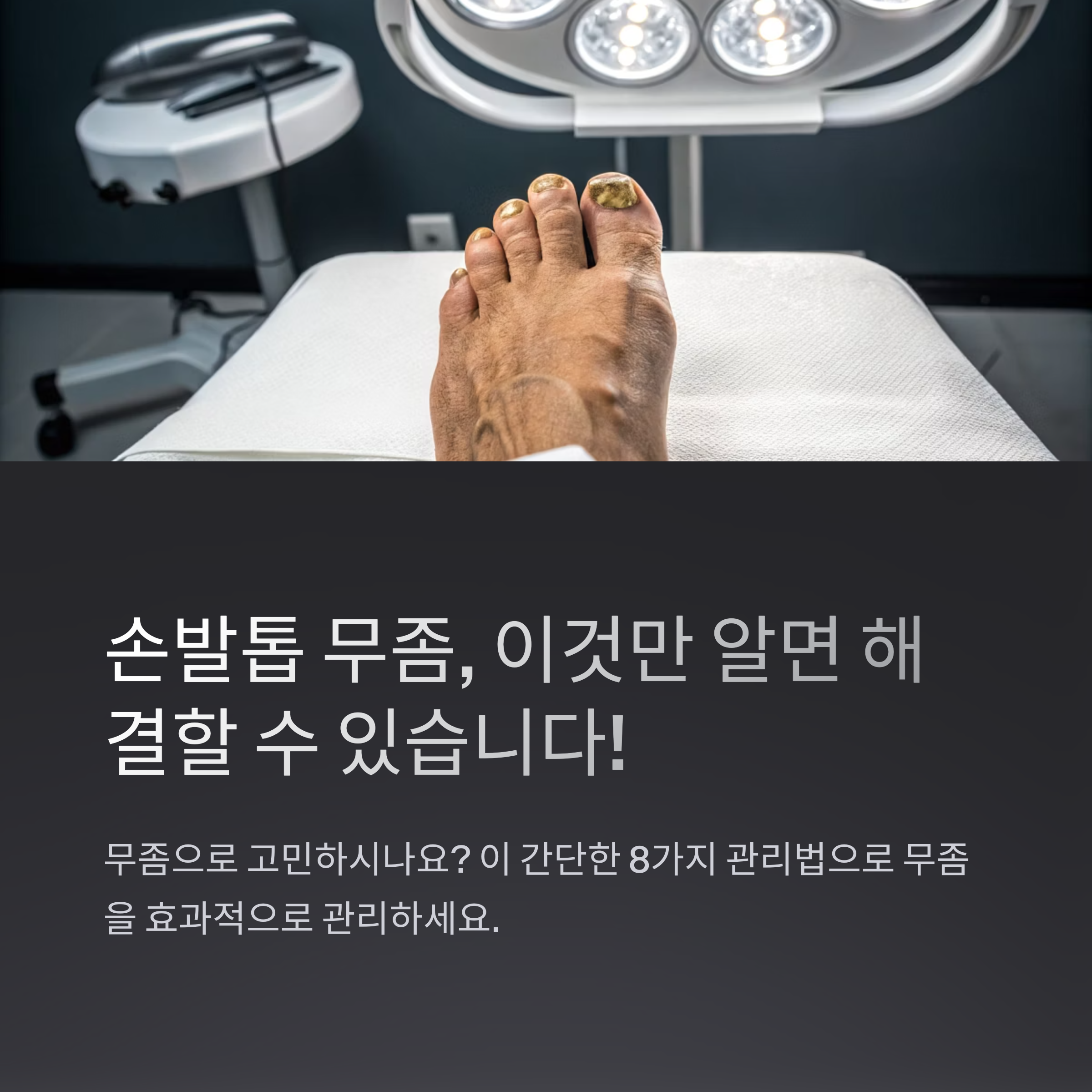 손발톱 무좀, 약 없이도 관리로 개선