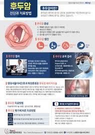 후두암