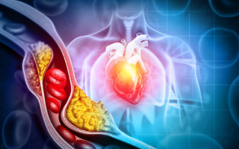 고지혈증 증상, 고지혈증에 좋은 음식, 고지혈증 수치 총정리 (2024ver)