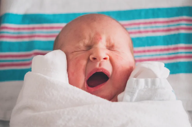 신생아 황달&#44; 황달 수치&#44; 초보맘