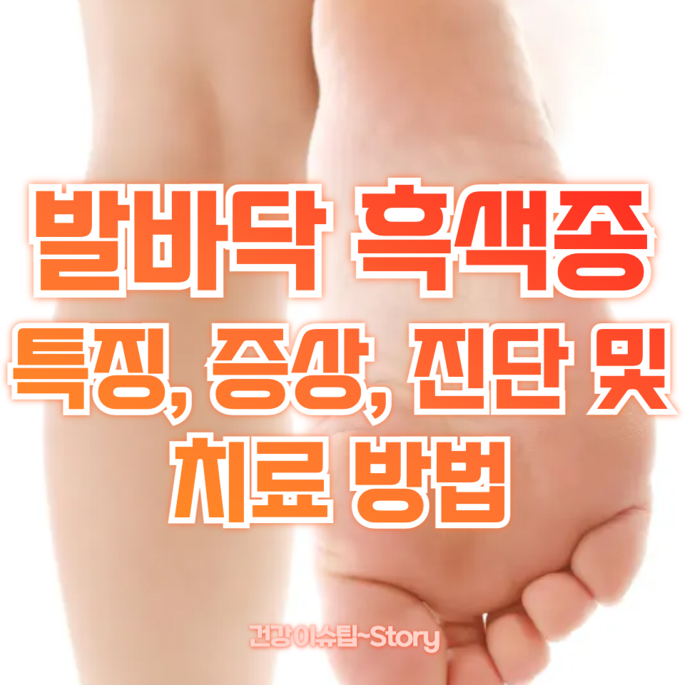 발바닥 흑색종