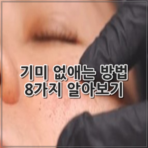 기미 없애는 방법 8가지 알아보기