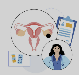 자궁근종 증상 수술후 회복기간 수술비용 좋은음식 등 총정리(최신)