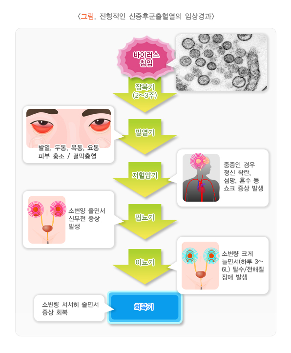 신증후군출혈열