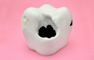 어금니가 아픈 원인