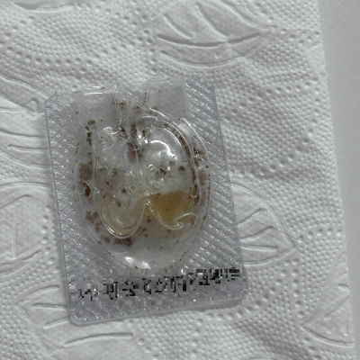 고양이 개미약 섭취 병원비