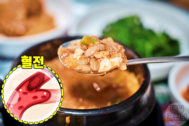 혈전에 좋은 음식 청국장,혈전 녹이는 음식,팁줌