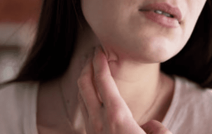 갑상선 기능 저하증 증상