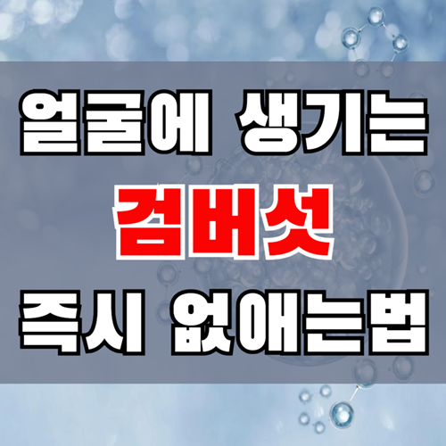 얼굴 검버섯이 생기는 원인