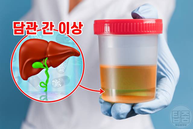 소변색깔 건강상태,소변색깔 주황색,소변색깔이 뿌옇다