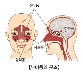 부비동염 증상
