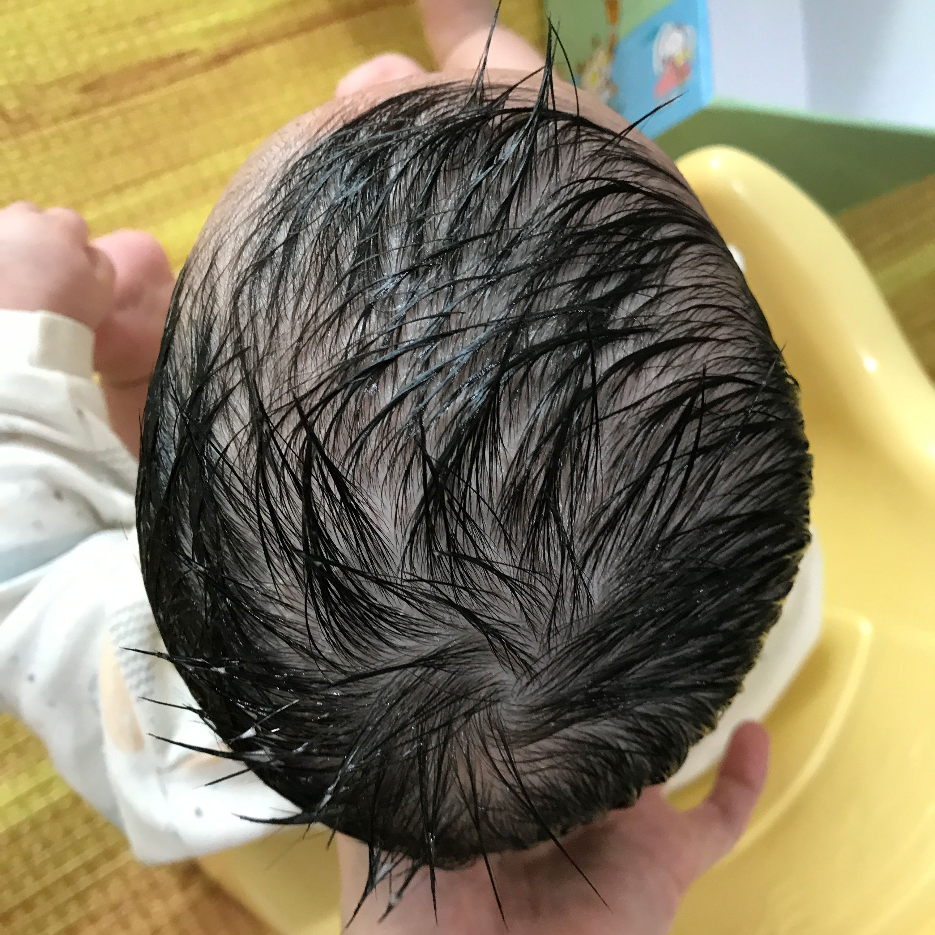 사두증 - 비비앤빕 두상 교정 베개 안씀