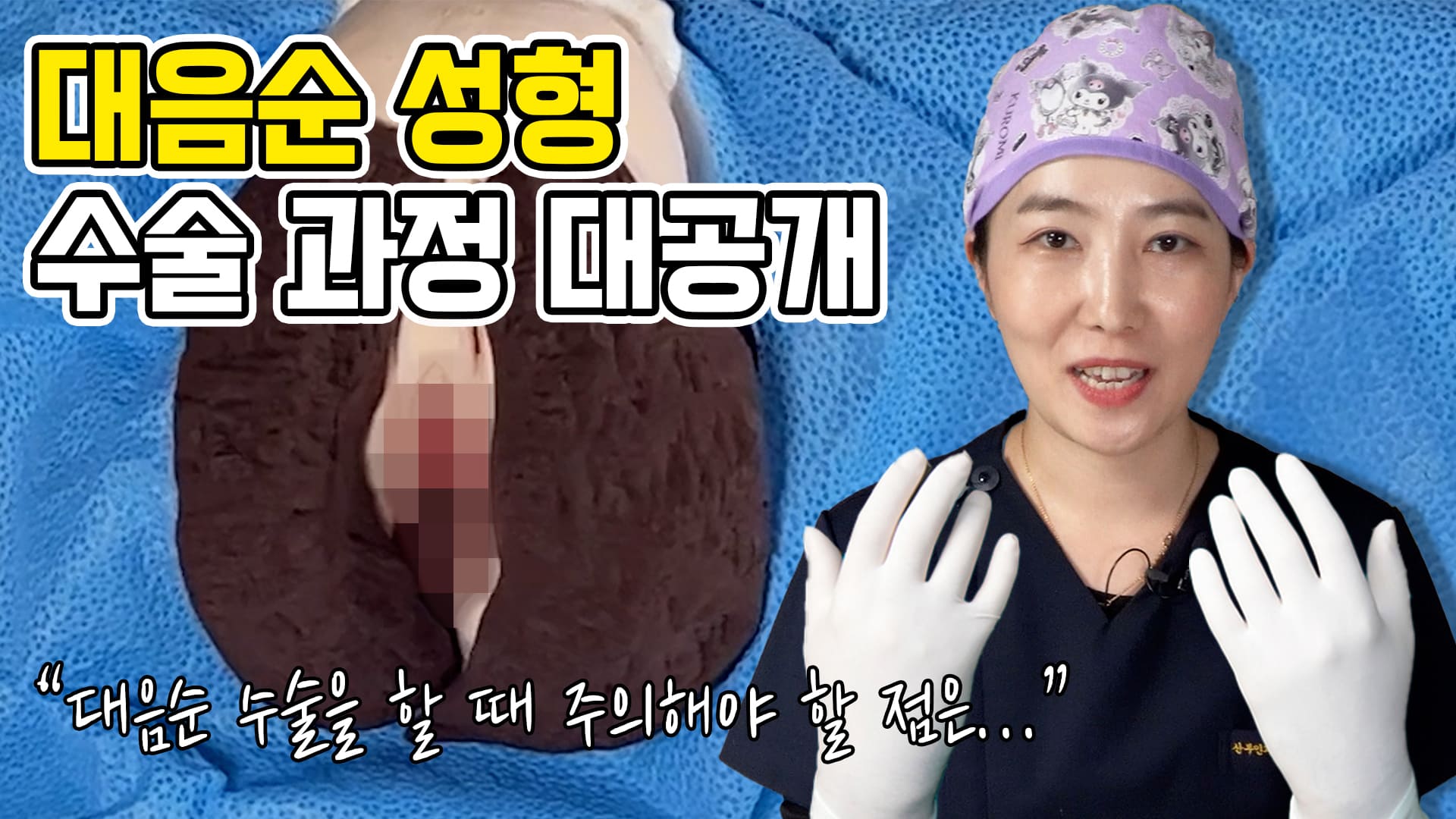대음순성형수술 과정 대.공.개 ※수술 시물레이션 포함!