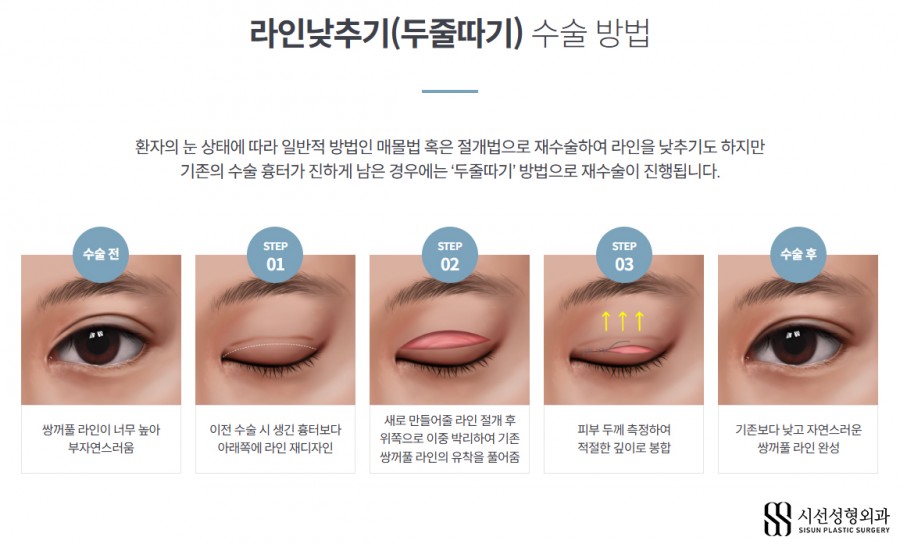 남자 쌍거플