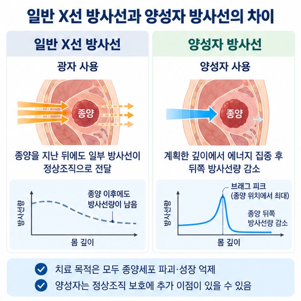 일반 X선 방사선과 양성자 방사선의 종양 뒤쪽 방사선량 차이를 비교하는 이미지