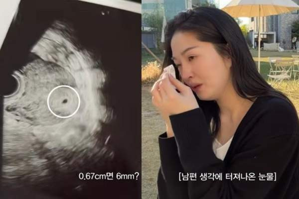 전진 아내 류이서 시험관 임신 7주 유산 고백｜배아 이식 성공 후 아기 성장 멈춘 이유&middot;재도전 계획