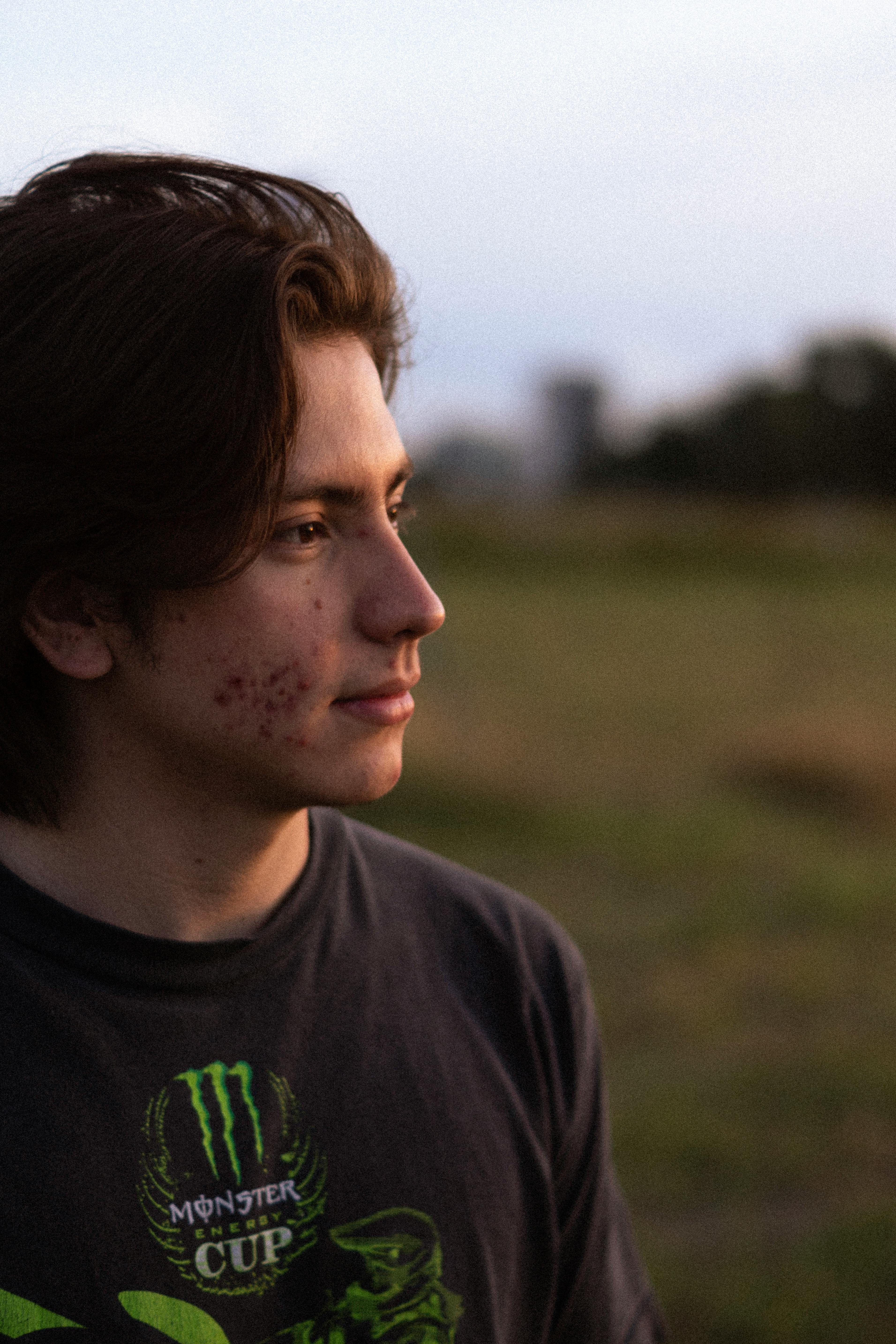 표피낭종의 원인