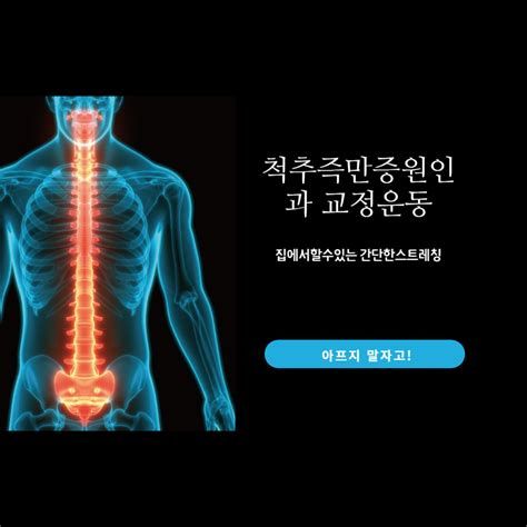 척추측만증 교정운동