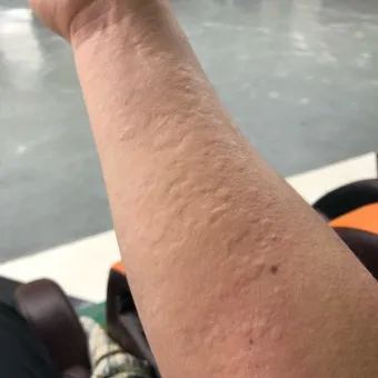 고양이 털 알레르기 완화 방법과 생활 관리 팁_5