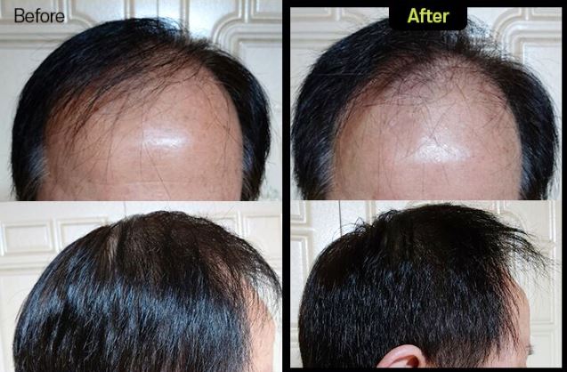 그래비티-샴푸-후기