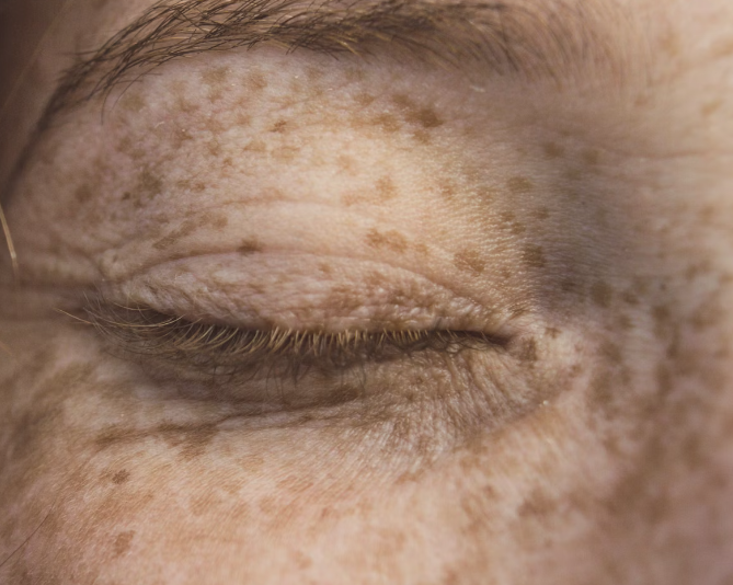 콜라겐 효능 : 피부개선