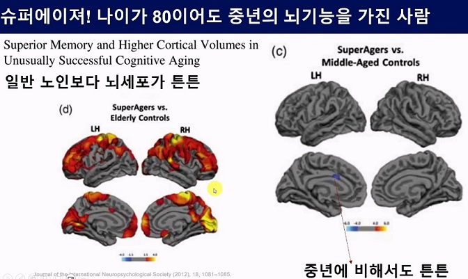 중년의뇌를갖는방법-슈퍼에이저