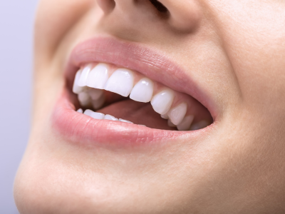 덴티오클린 부작용 모르면 손해보는 복용방법