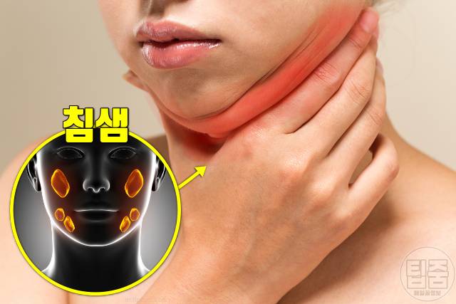 귀밑 턱 부음 원인 타석증 귀밑 턱이 부었어요