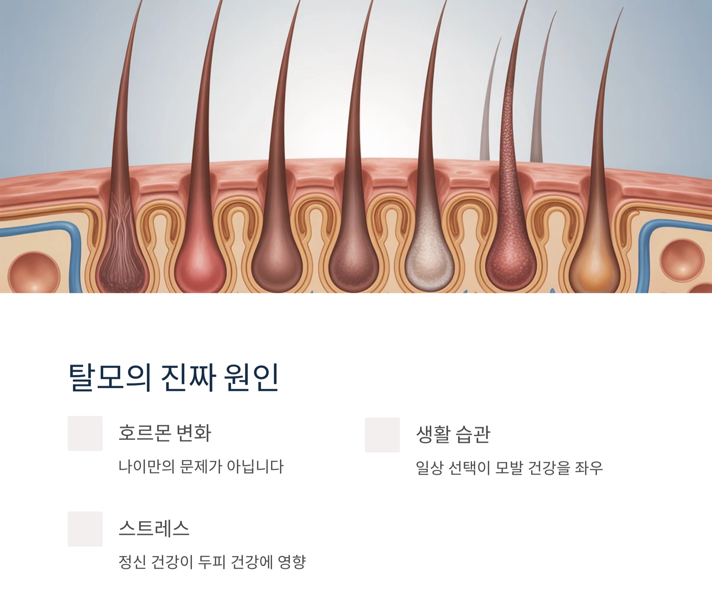 중년 탈모, 나만의 문제가 아니다? 남녀 모두 알아야 할 핵심 진실
