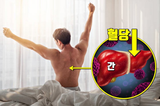 당뇨 전조 증상,당뇨 전단계 증상,숙취 과음 다음날 몸이 개운,기지개