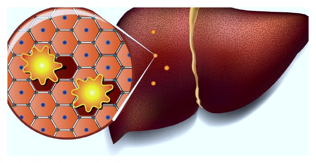 간수치가-높으면-나타나는-증상