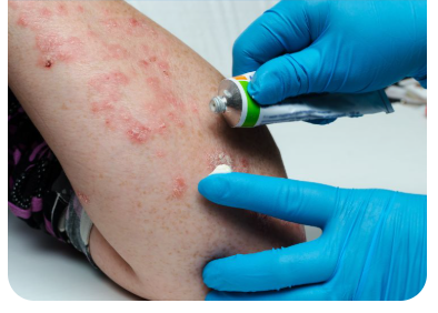 당뇨병-간질환-가려움