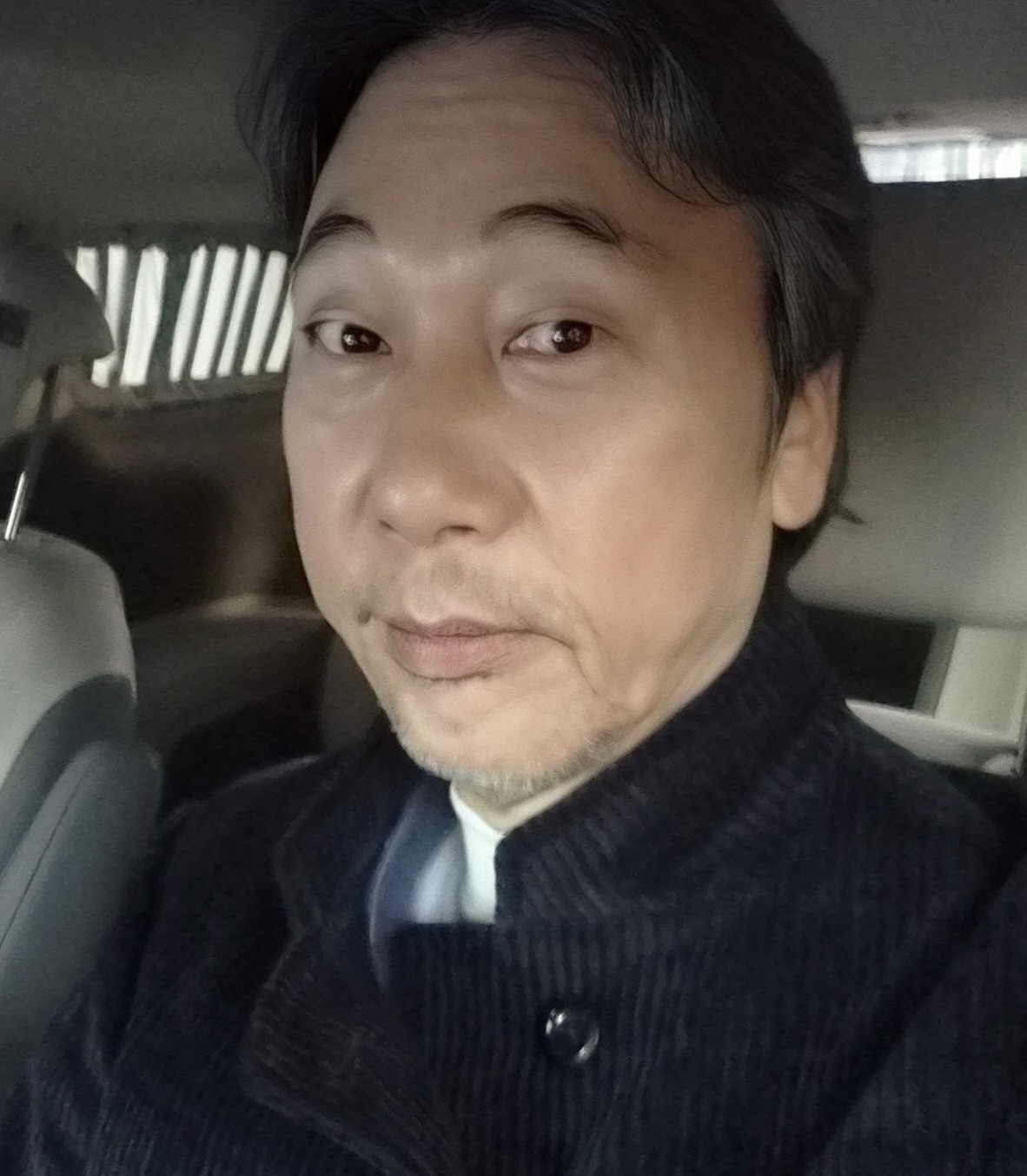 이문세 백내장 수술